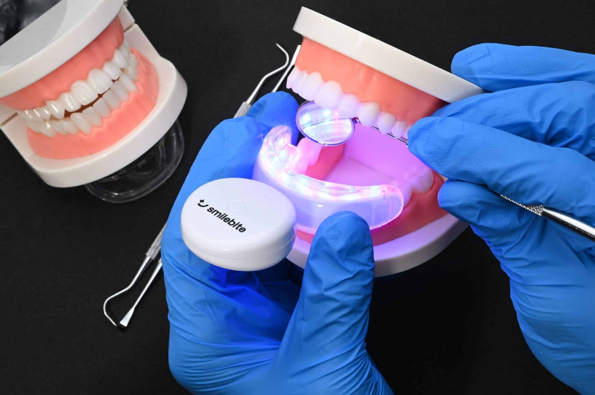 Qualitätsmerkmale eines guten Zahnaufheller Sets